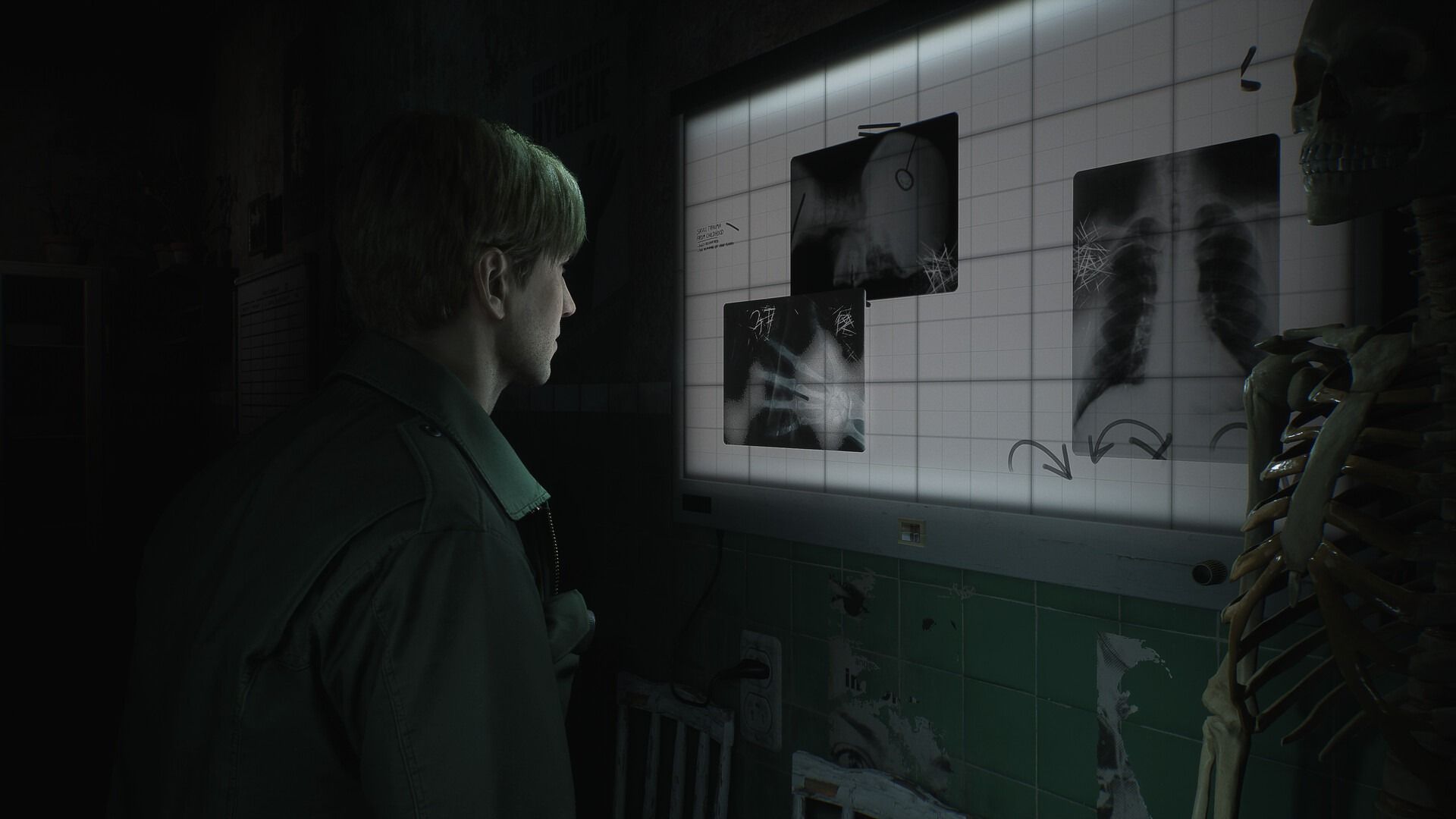 Silent Hill 2 Remake’s Audio Sends Shivers Down Fans' Spines